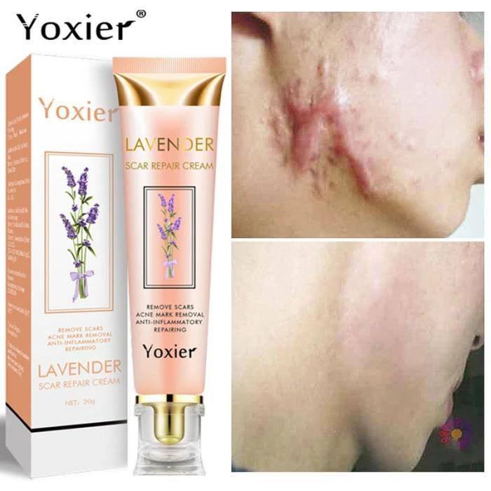 CREME YOXIER